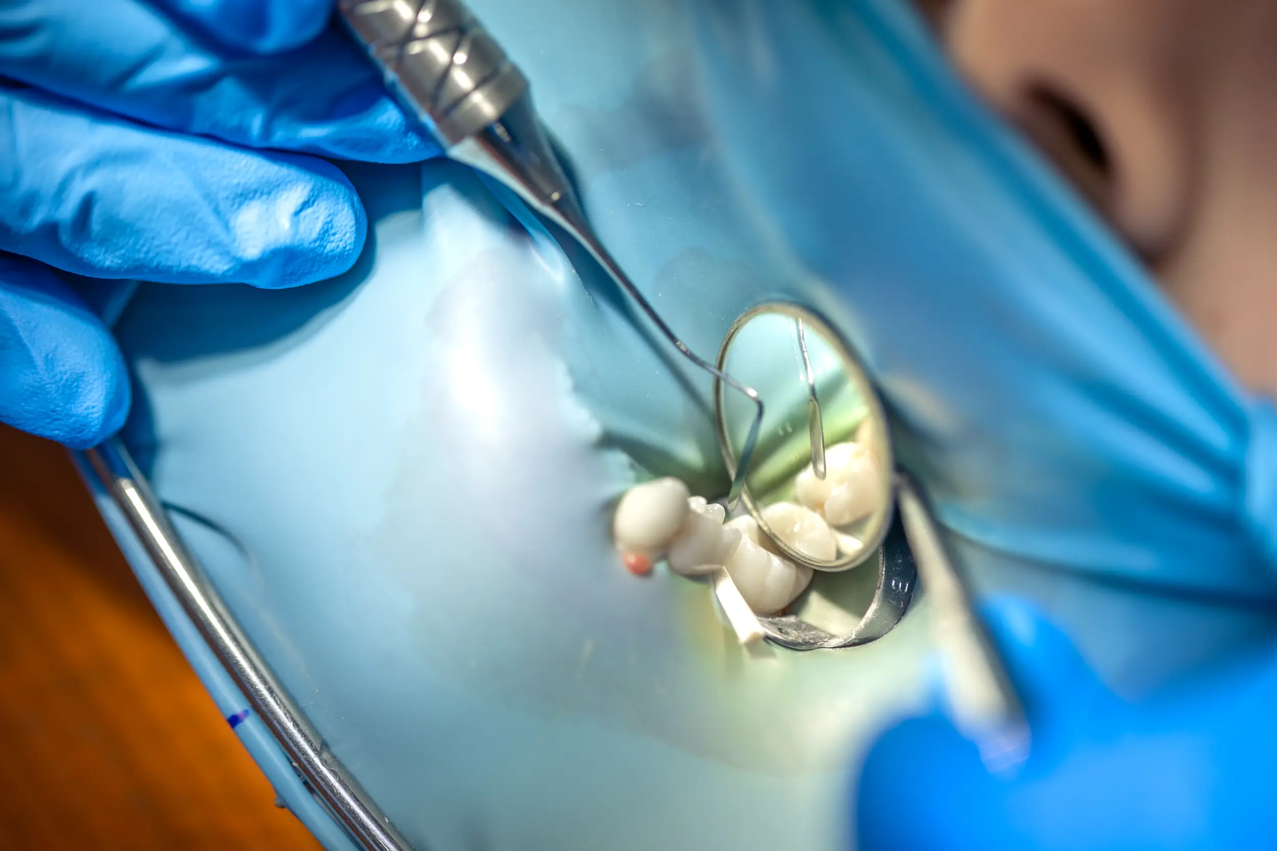 Endodontie-DrDehelean_003 - Clinica Stomatologica Dr Dehelean Bucuresti