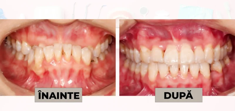 Cazuri clinice DrDehelean