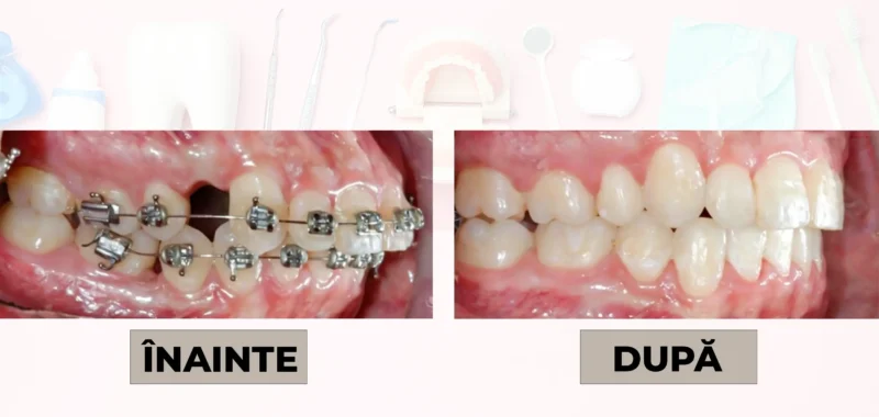 Cazuri clinice DrDehelean