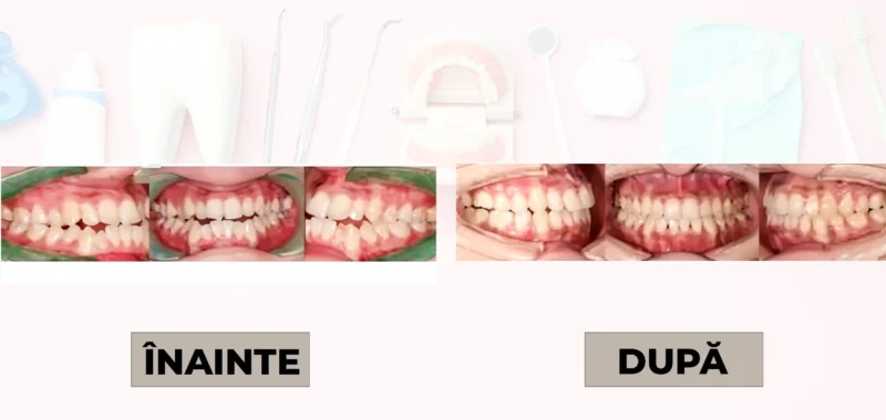 Cazuri clinice DrDehelean