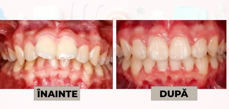 Cazuri clinice DrDehelean