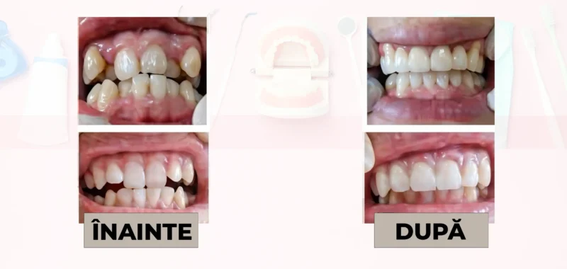 Cazuri clinice DrDehelean
