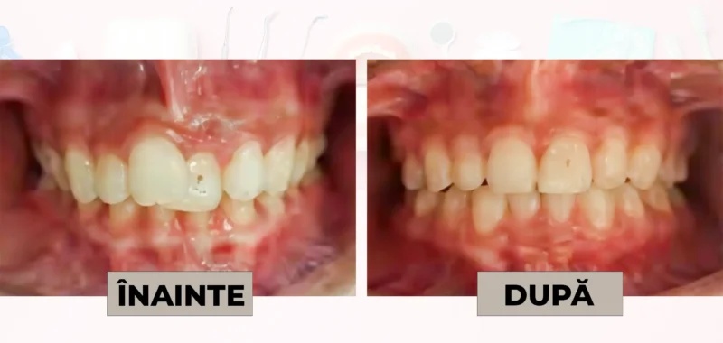Cazuri clinice DrDehelean