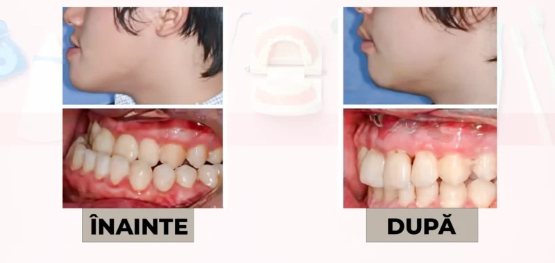 Cazuri clinice DrDehelean