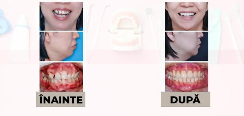 Cazuri clinice DrDehelean