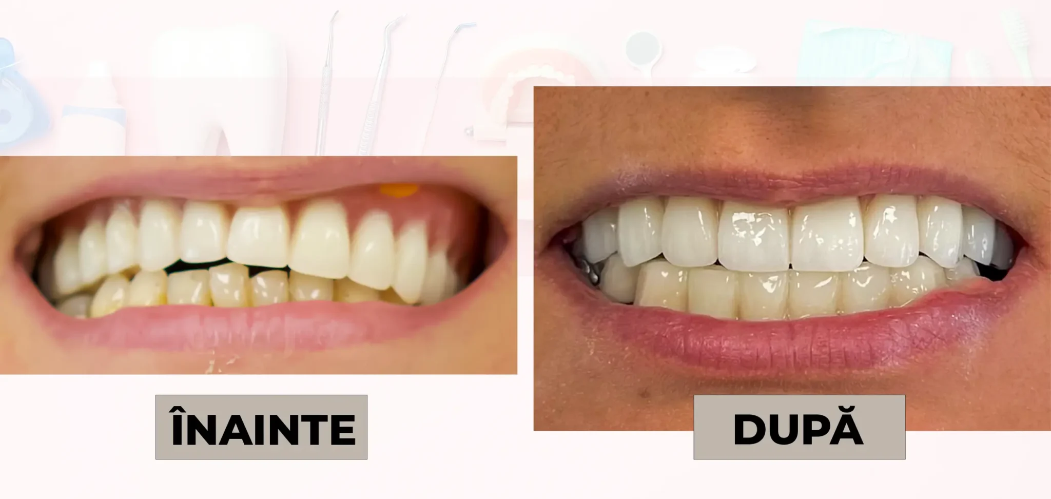 Cazuri_clinice_DrDehelean_008 - Clinica Stomatologica Dr Dehelean Bucuresti
