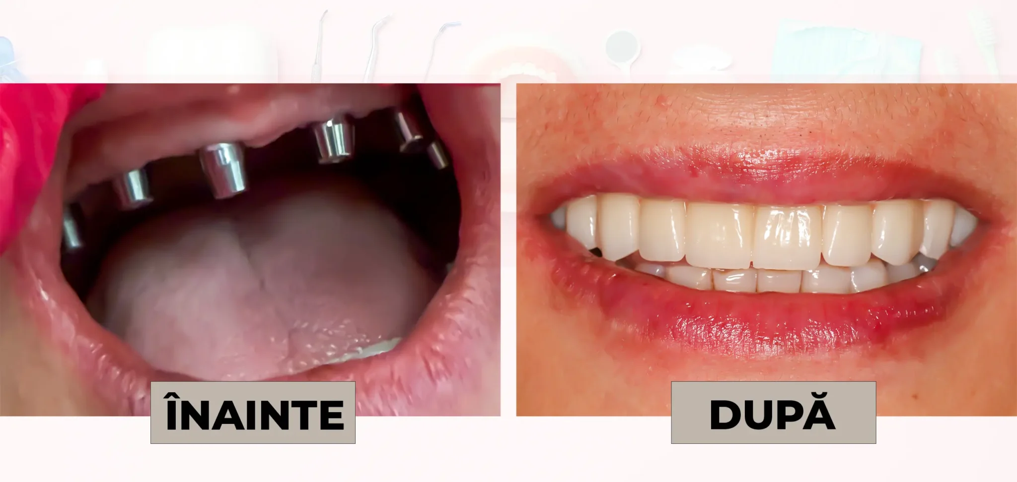 Cazuri_clinice_DrDehelean_015 - Clinica Stomatologica Dr Dehelean Bucuresti