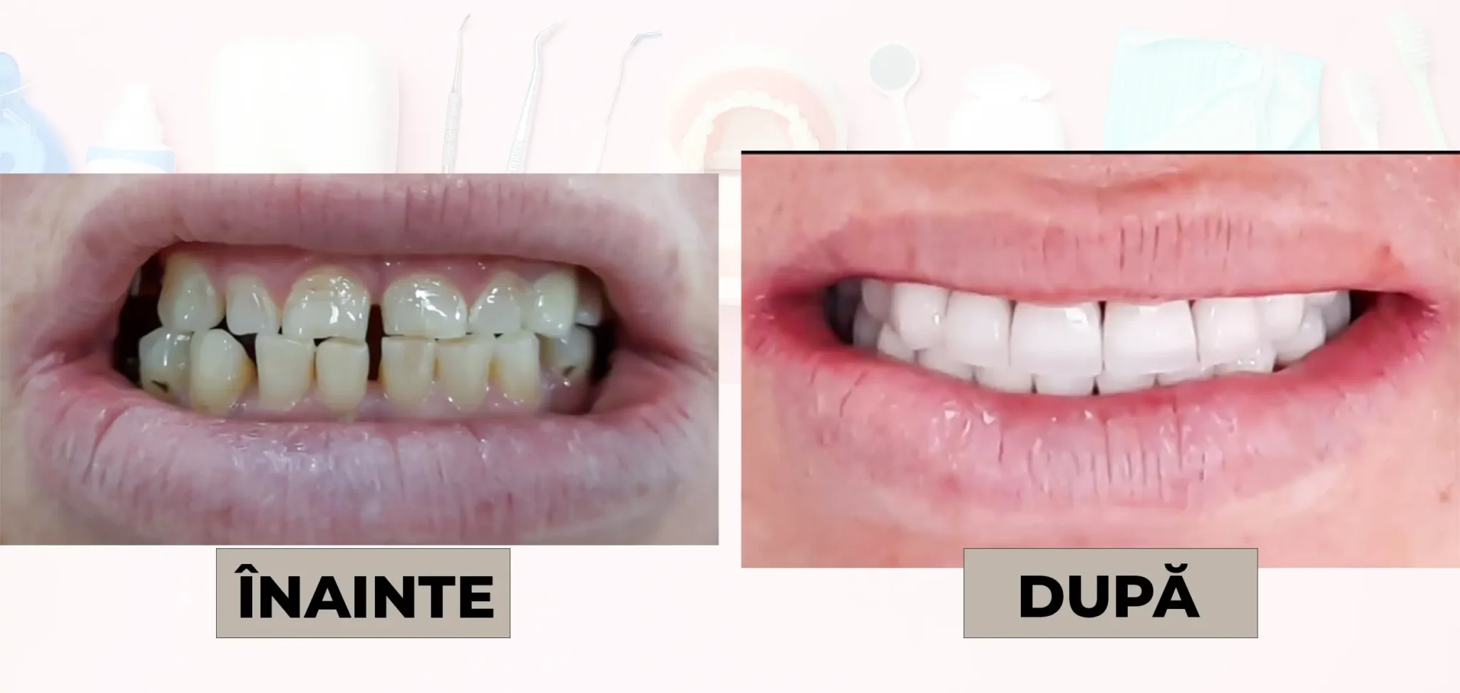 Cazuri_clinice_DrDehelean_033 - Clinica Stomatologica Dr Dehelean Bucuresti